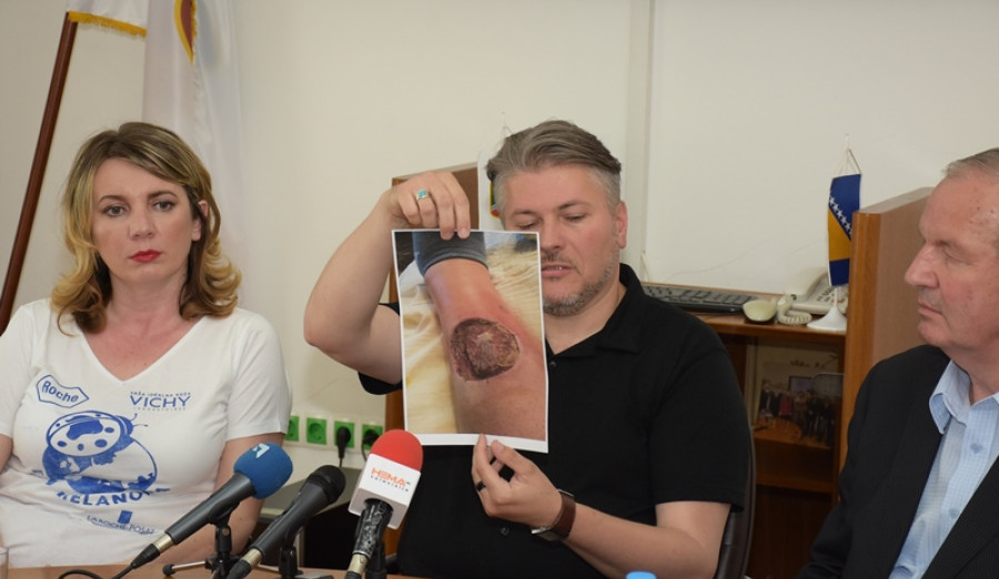 Počela velika kampanja suzbijanja melanoma kože „Euromelanoma 2017“